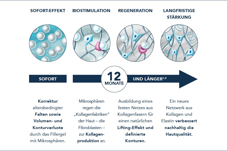 Wirkmechanismus der Biostimulation bei Radiesse®