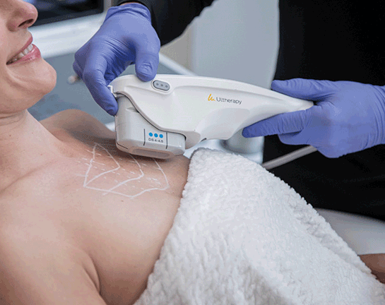 live ultherapy prime behanldung am decollete einer frau