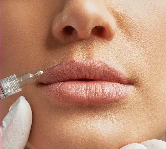 Nahaufnahme der Lippenpartie, während eine Kanüle am Lippenrand ansetzt und eine Hand mit Handschuhen die Spritze führt.